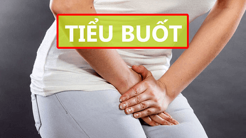 Tiểu buốt ở nữ giới là bệnh gì?